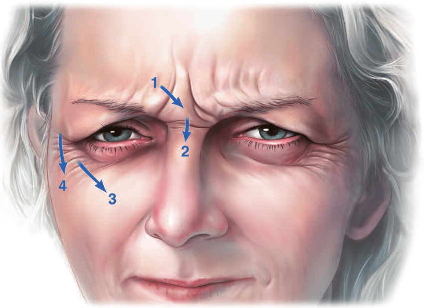 Estetichal botox injection