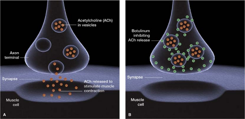 Botox Effect Mechanism